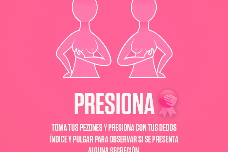 TEC Salud Cancer de mama 2